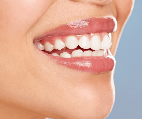 dental care