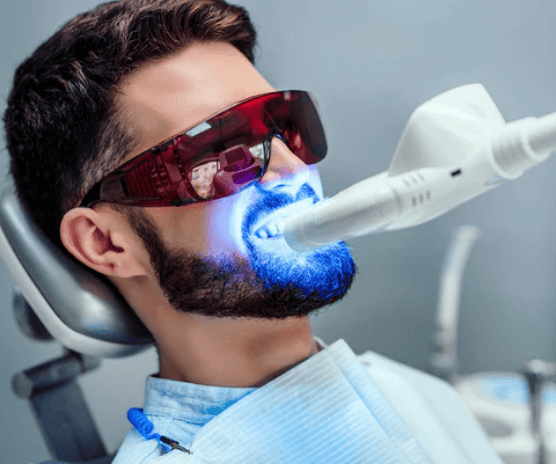 teeth whitening