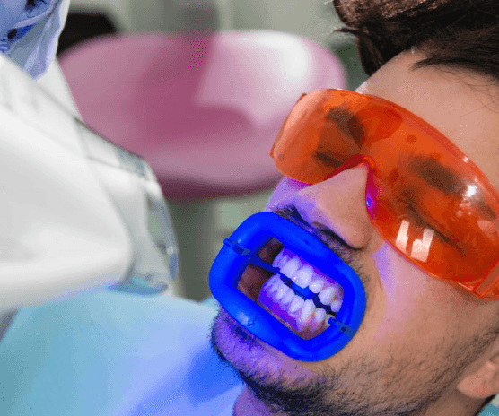 teeth whitening
