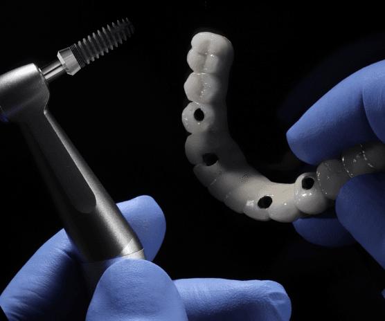 dentures