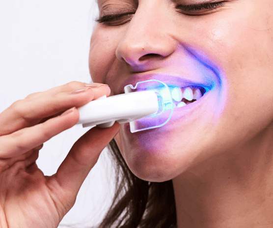 teeth whitening