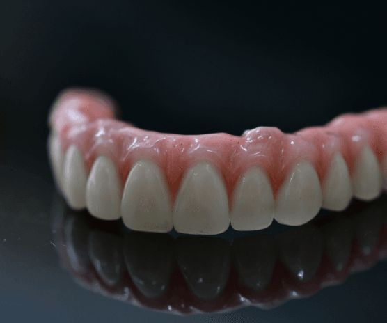 dentures