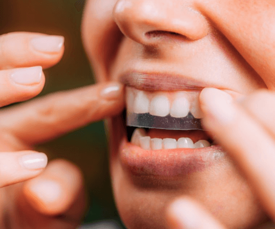 oral hygiene
