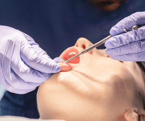 dental checkup