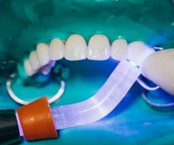 teeth whitening