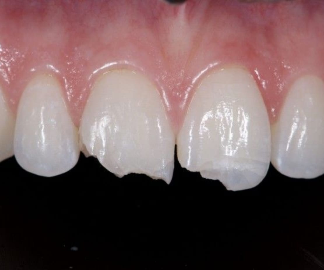 Restorative Dentistry