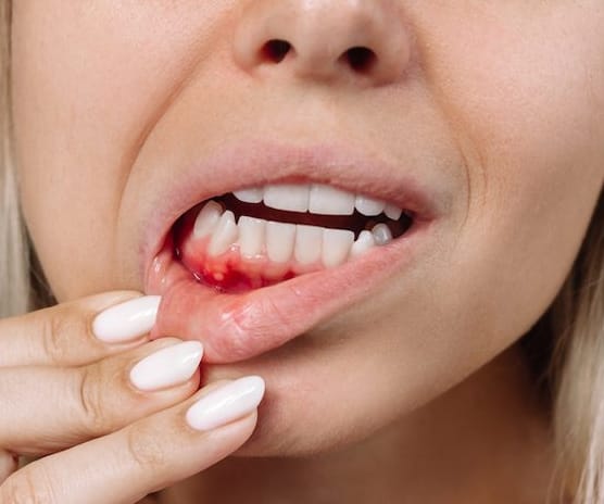 Uncontrolled Bleeding